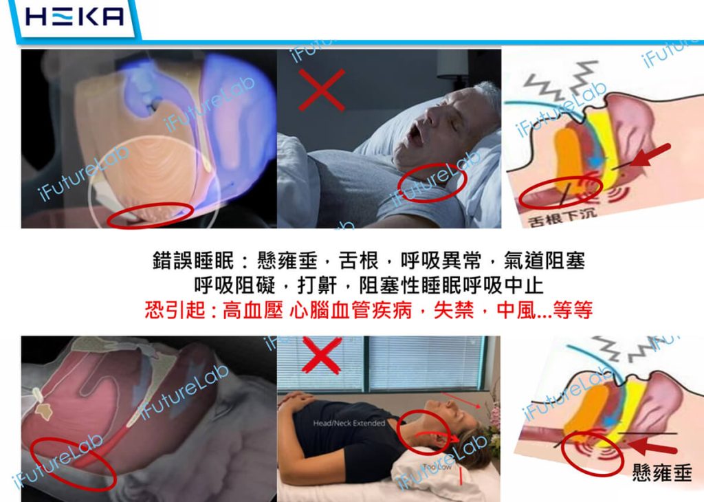 錯誤睡眠導致疾病